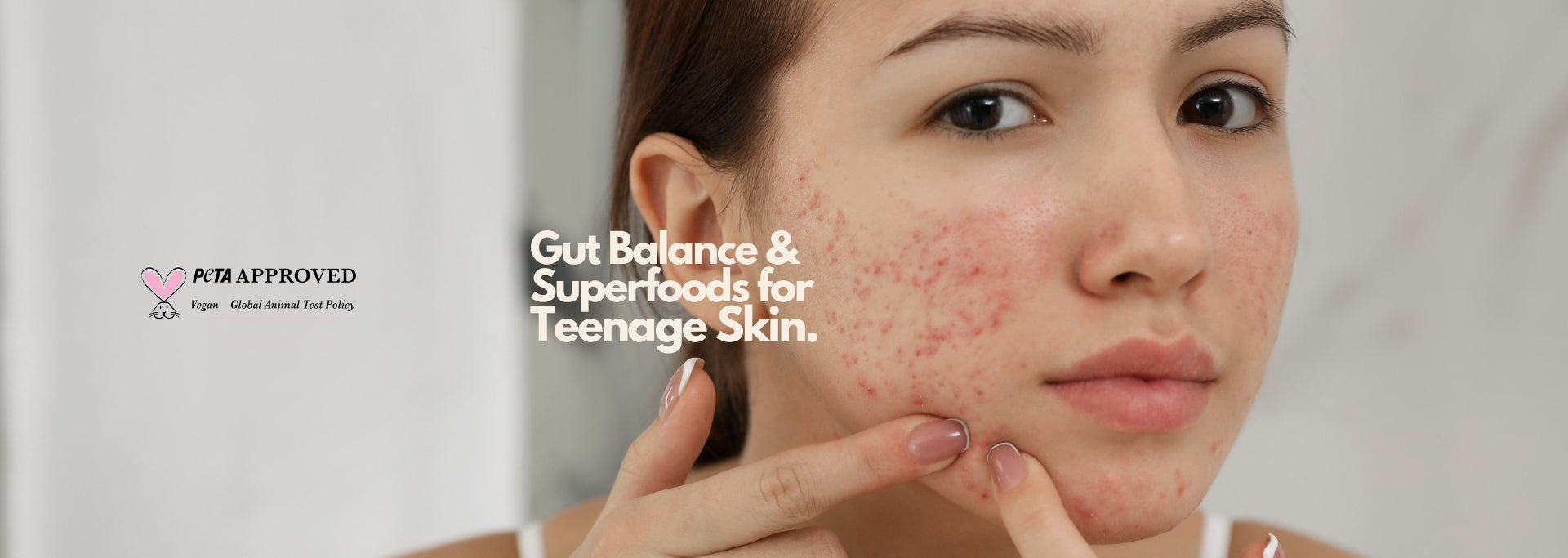 Balancing Teenage Hormones: How Gut Health and Superfoods Improve Skin
