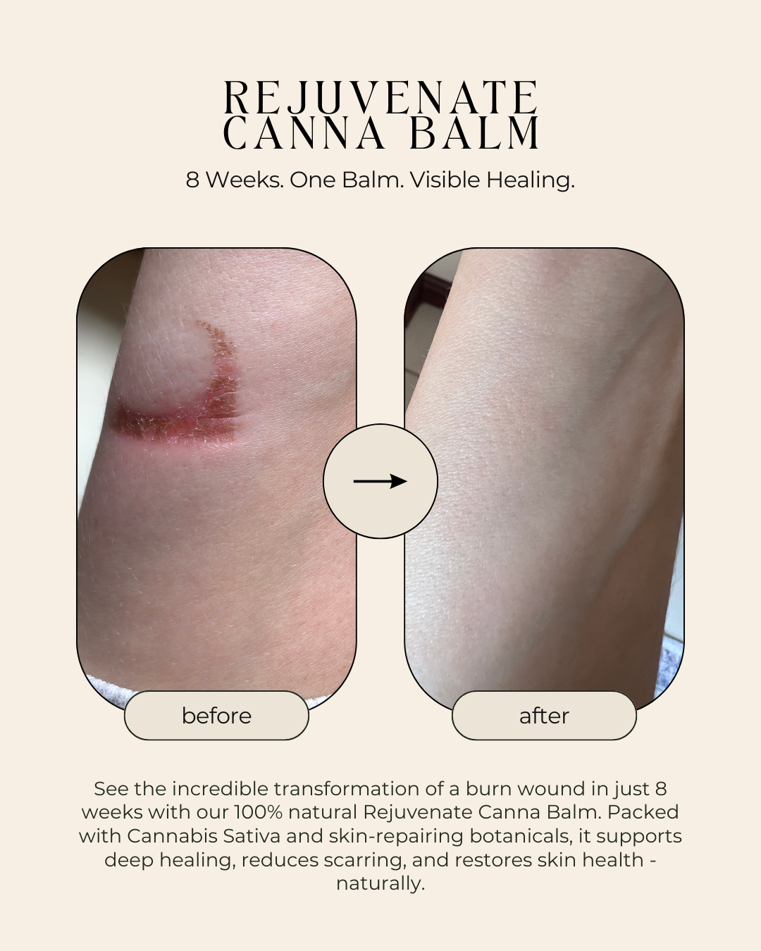 Rejuvenate Canna Balm – Superfood Skin Rescue