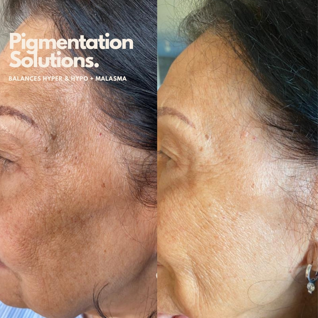 Holistic Skin Consultation for the Ultimate Glow