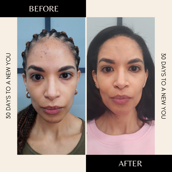 GLOW: The trifecta of skin, gut and mental health