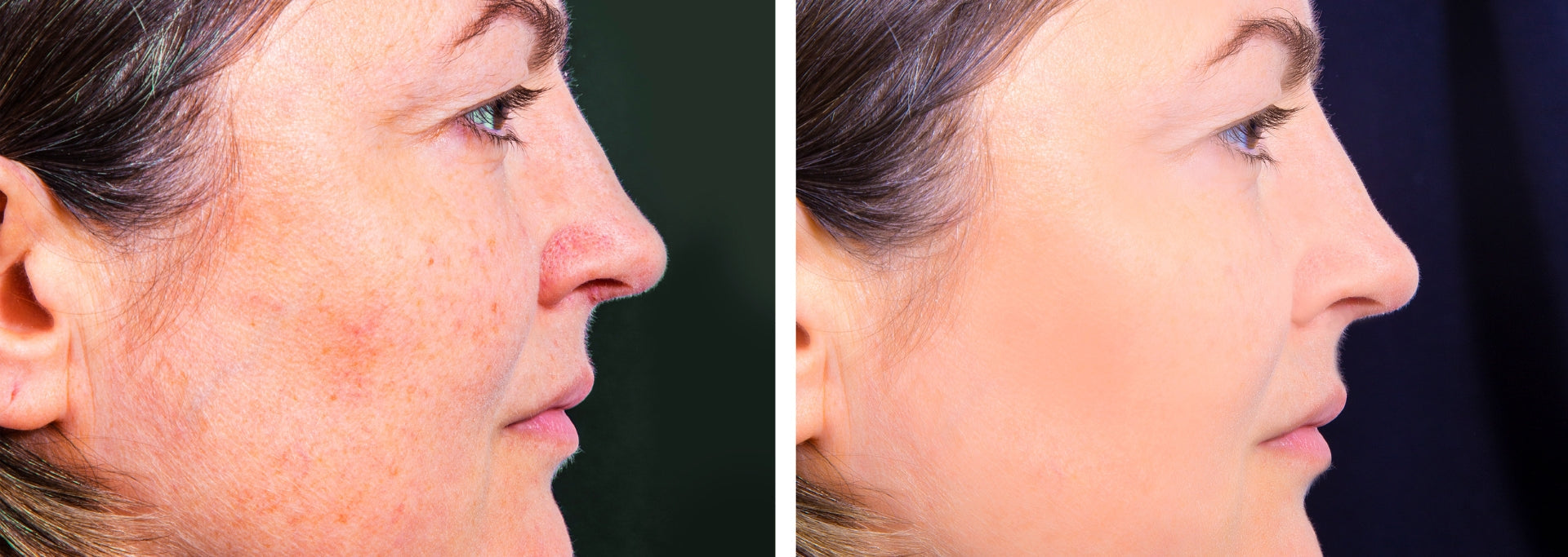 Sensitive Skin - The Art of Rebalancing for Calm, Glowing Skin
